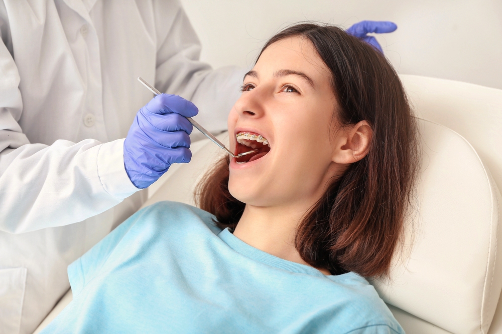 How to FIx Overbite in Little Falls, NJ