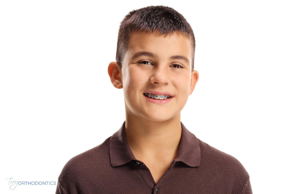 Smiling teenage boy with braces, showcasing progress in orthodontic braces for overbite in little falls and metuchen, nj.